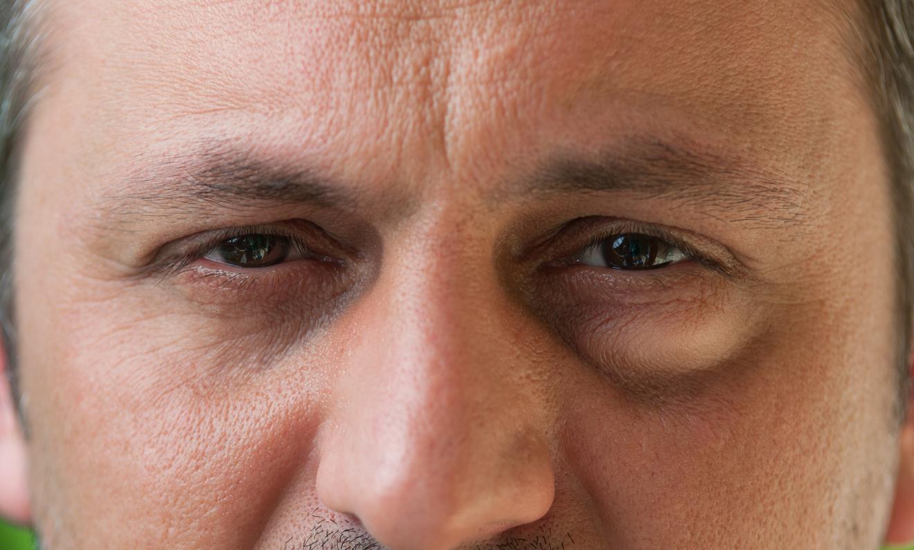 Me desperté con dolor de cabeza y ojos hinchados