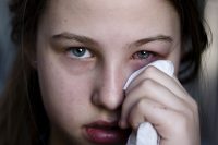Adolescente limpiándose un ojo con un pañuelo