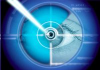 Aplicación del láser sobre ojo azul