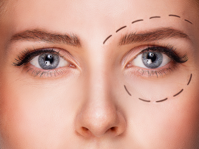 Sabes qué es la oculoplastia?