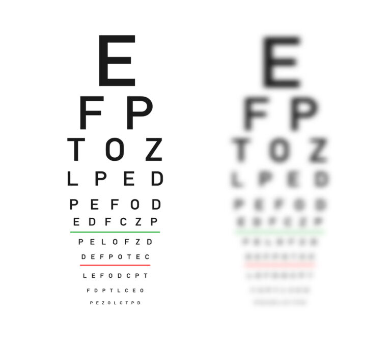 agudeza-visual-qu-es-y-c-mo-se-mide-test-blog-de-cl-nica-baviera