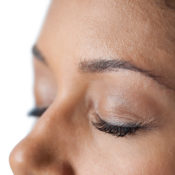 Párpados resecos, dermatitis debajo del ojo, alergia en las ojeras o eczema palpebral:  ¿es lo mismo?