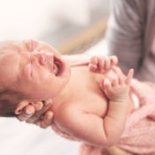 ¿Cómo tratar los ojos llorosos en bebés?