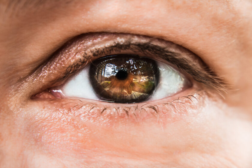 Principales causas del ojo hinchado Blog de Clínica Baviera