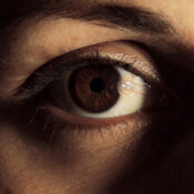 Carnosidad en los ojos: síntomas, causas y tratamiento