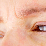 Psoriasis en los ojos: síntomas y tratamiento