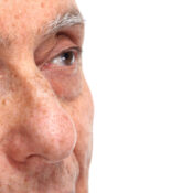 Blefaroconjuntivitis: causas, síntomas y tratamiento