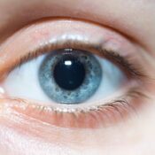 Pupilas dilatadas o midriasis: ¿por qué pasa y cómo prevenir la dilatación?