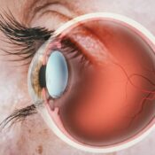 Retina: una parte fundamental del ojo