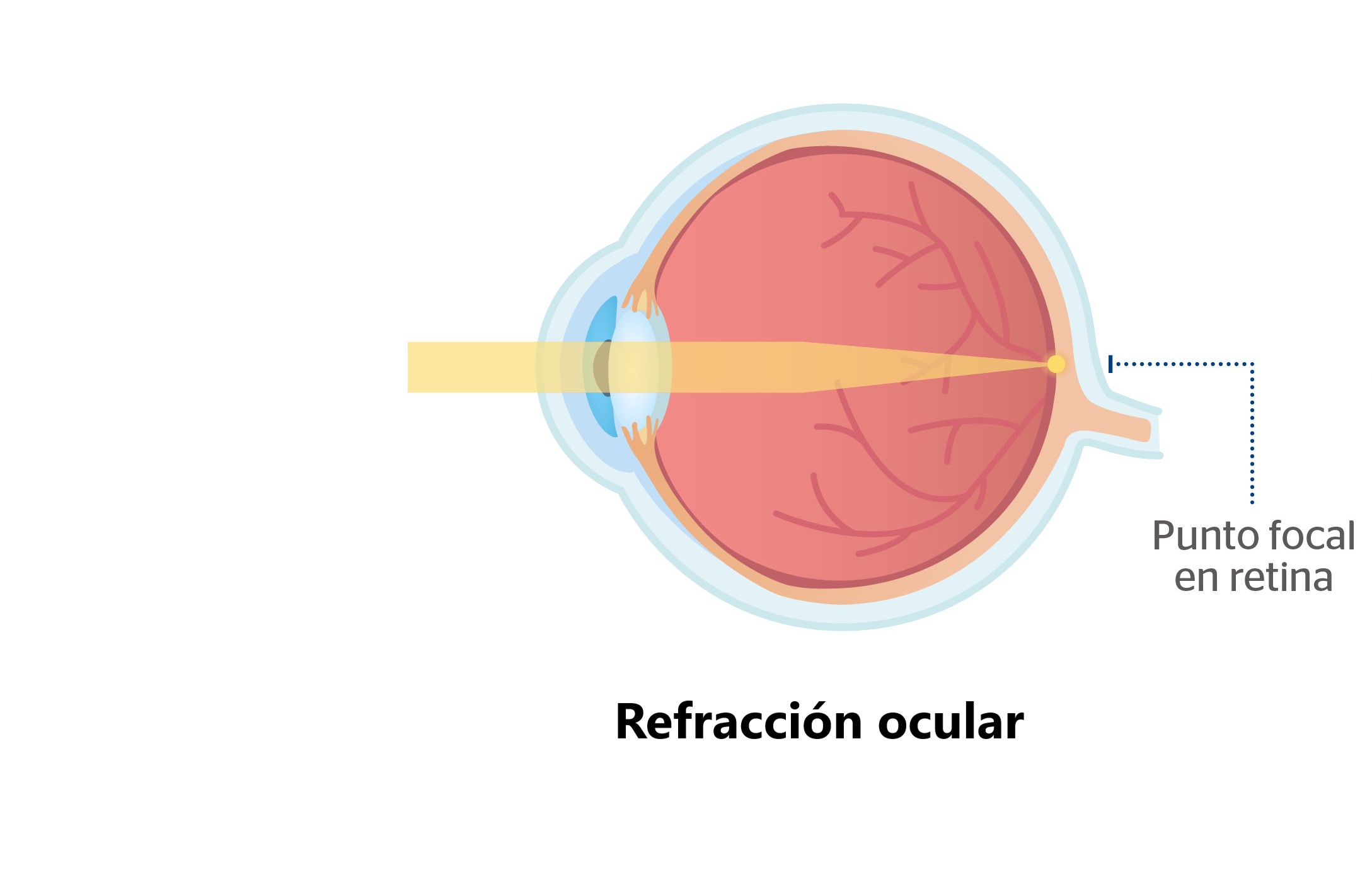 Cómo se produce la refracción del ojo